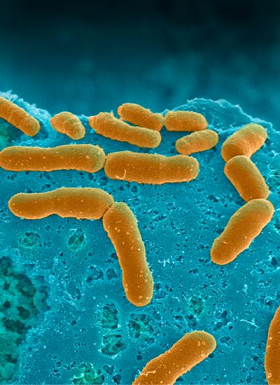Human Microbiome Cultured in Anaerobic Intestine Chip