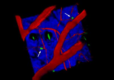 New Immune Cells Found in Skin