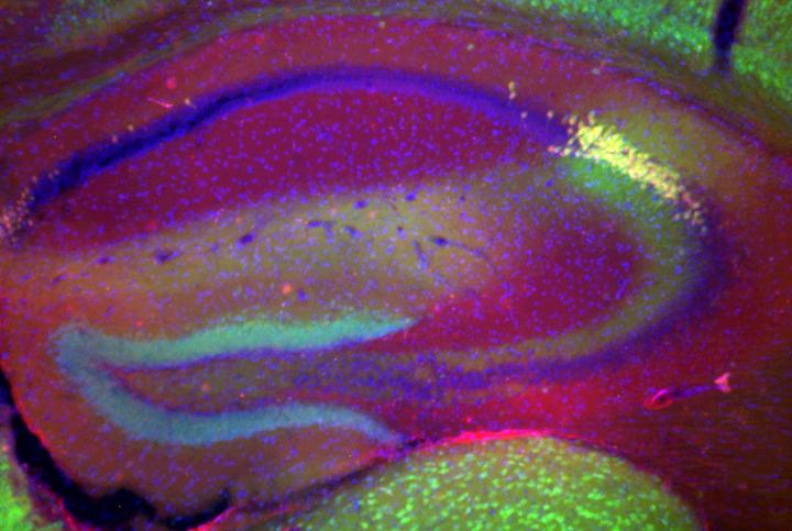 Cre Recombinase Expression in CA2 Pyramidal Cells