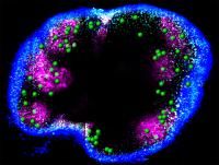 Lymph Node Showing Location of Follicular Memory T Cells