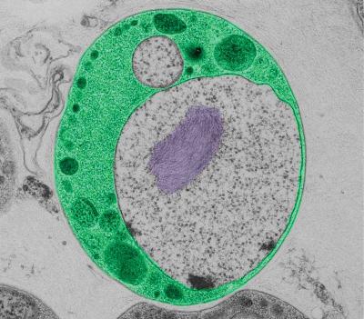 Bacteria with Membrane-Coat Protein
