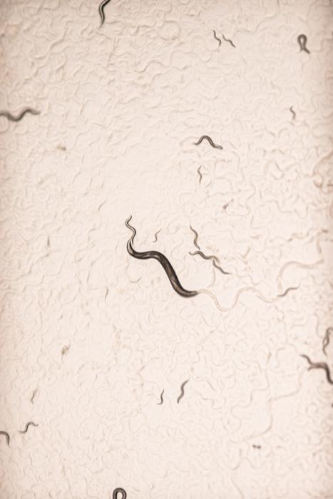 C. elegans under microscope.