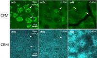 3D Images of Conjunctival Goblet Cells