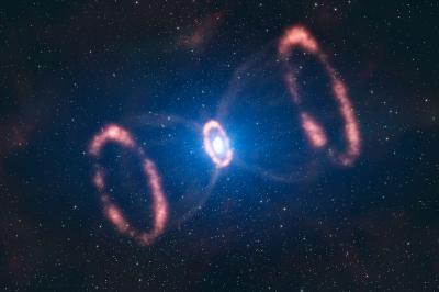 Material around SN 1987A (Artist's Impression)