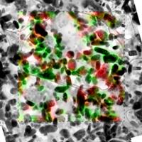 LFP Particles