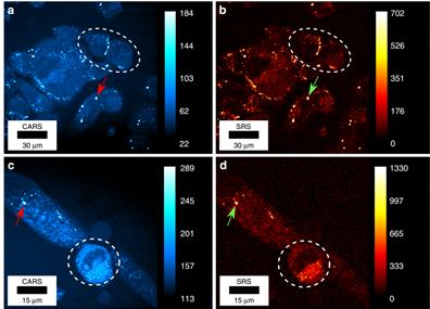 Living Human Cells