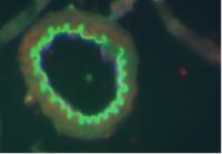 Leukemic and Chemokine Cells (2 of 2)