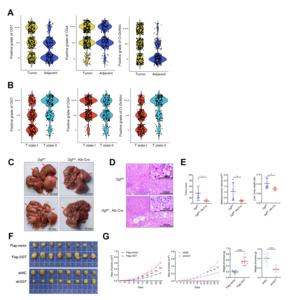 OGT Accelerates Liver Tumor Growth