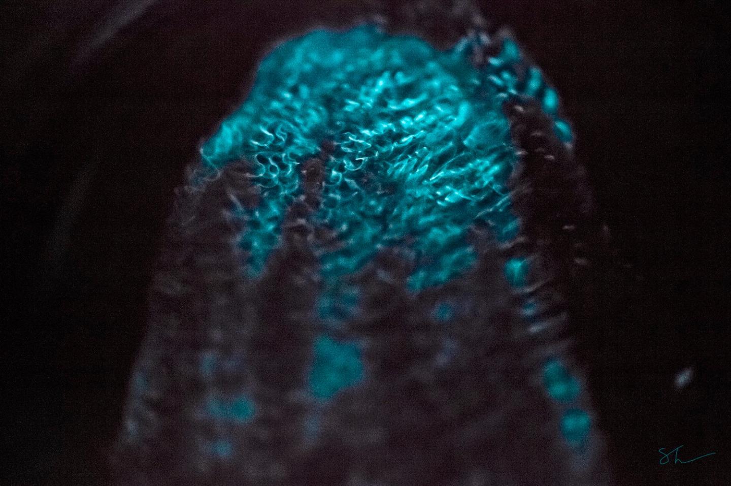 Bioluminescence