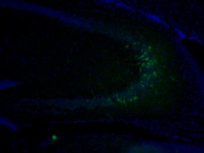 Early Developmental Experiences Influence DNA