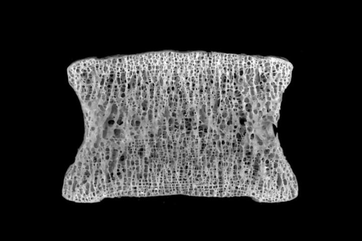 An Image of Normal Bone