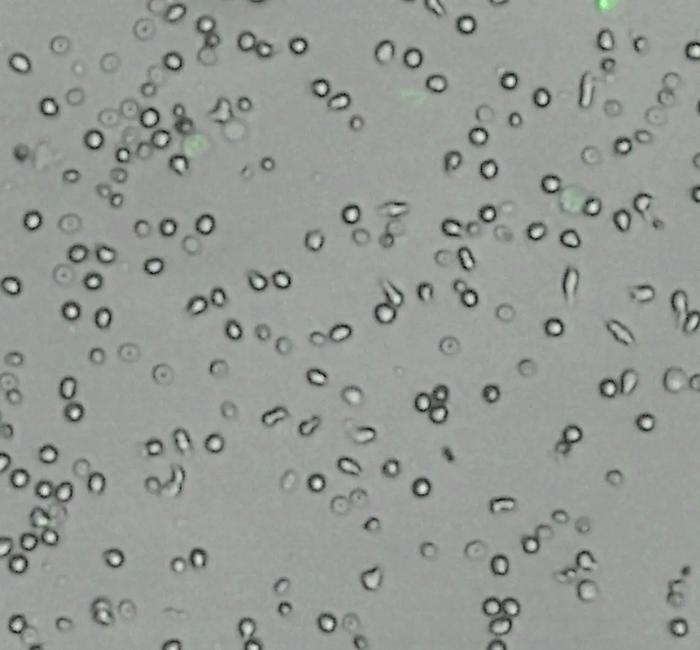 Neutrophil extracellular trap (NET)-forming neutrophils