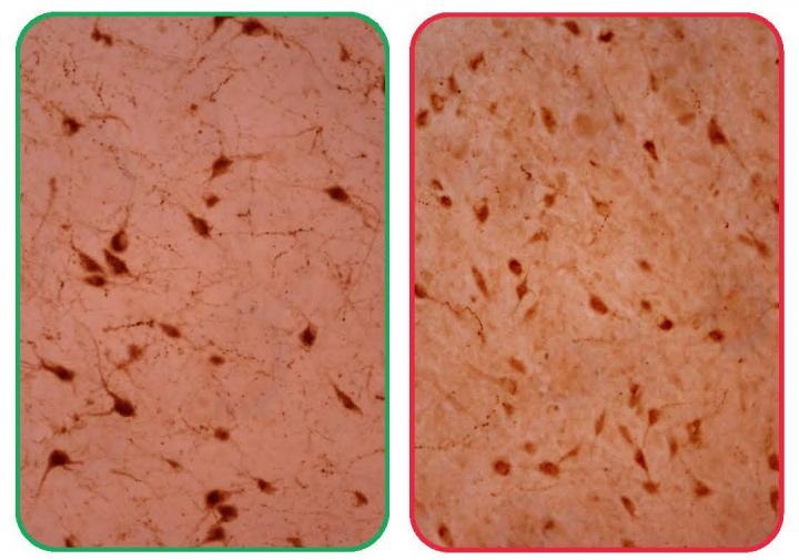 Hypocretin-producing Neurons