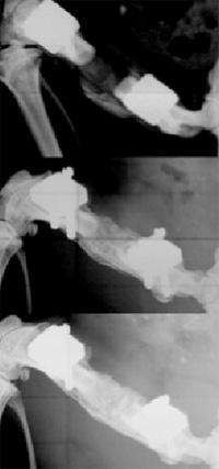 Bone Defect
