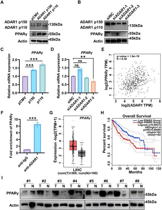 ADAR1 promotes liver cancer progression via post-transcriptional regulation of PPARγ