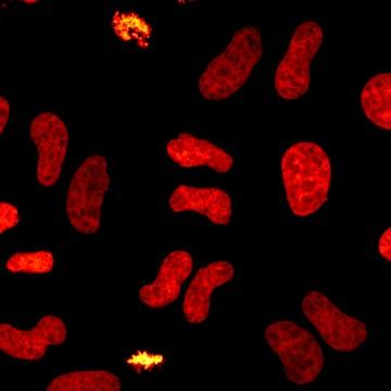HeLa Cells Stained with SiR-Hoechst