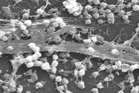 Biofilm On A Catheter