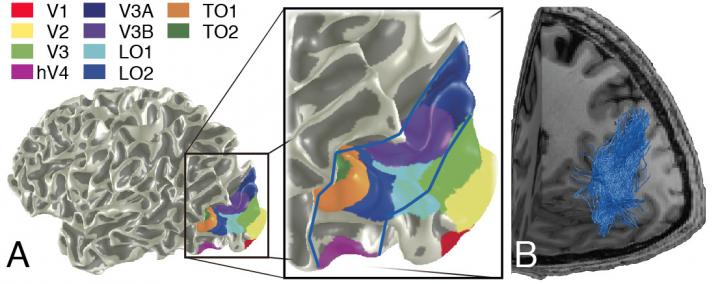 VOF fMRI Image