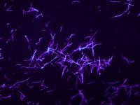 Streptomyces philanthi
