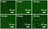The secrets of secretion | EurekAlert!