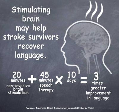 Stimulating Brain May Help Stroke Survivors Recover Language
