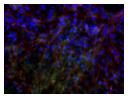 Stem-Cell-Derived Osteoblasts