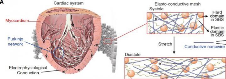 Mesh Implant Gives Failing Heart a Boost (1 of 5)