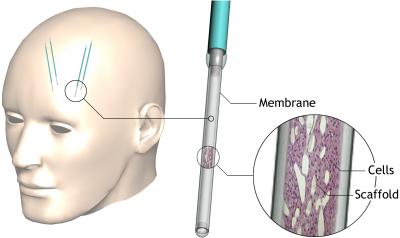 EC Biodelivery System