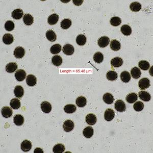 Zoonotic endoparasites and Toxoplasma gondii seropositivity in free-roaming cats (Felis catus) from New York City boroughs