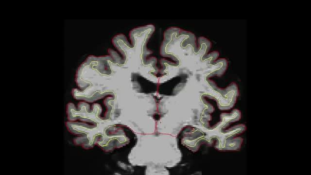 SuperAger Cortex Animation