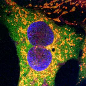 Human cells edited with retron-based gene editing method