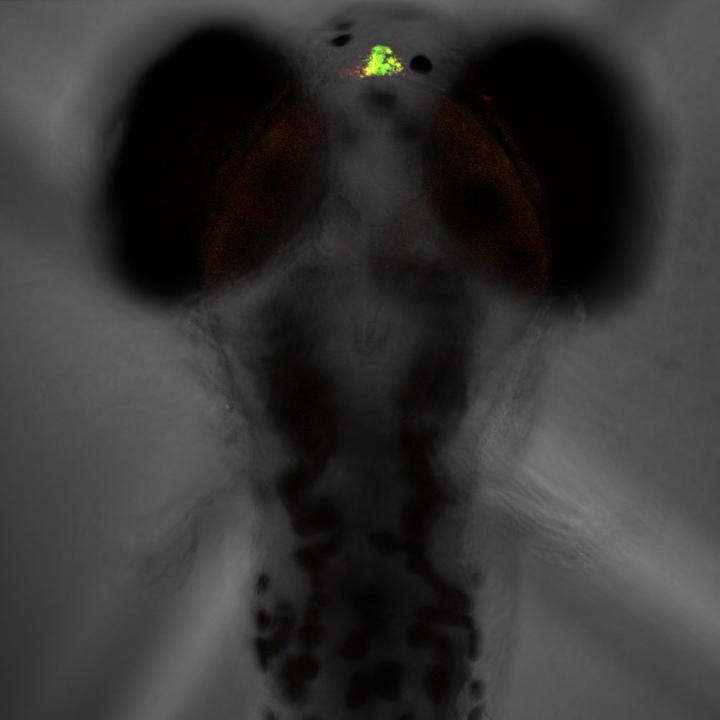Larval Zebrafish Pineal Gland, Where Melatonin is Made