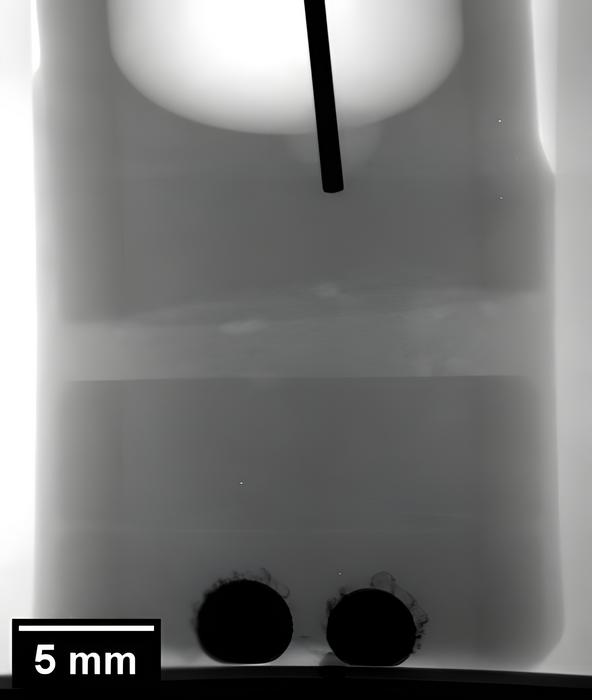 X-ray radiography of a sodium-zinc cell with sodium anode