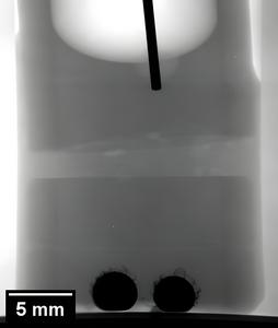 X-ray radiography of a sodium-zinc cell with sodium anode