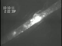 Shear-Activated Nanotherapeutic Clears Obstruction