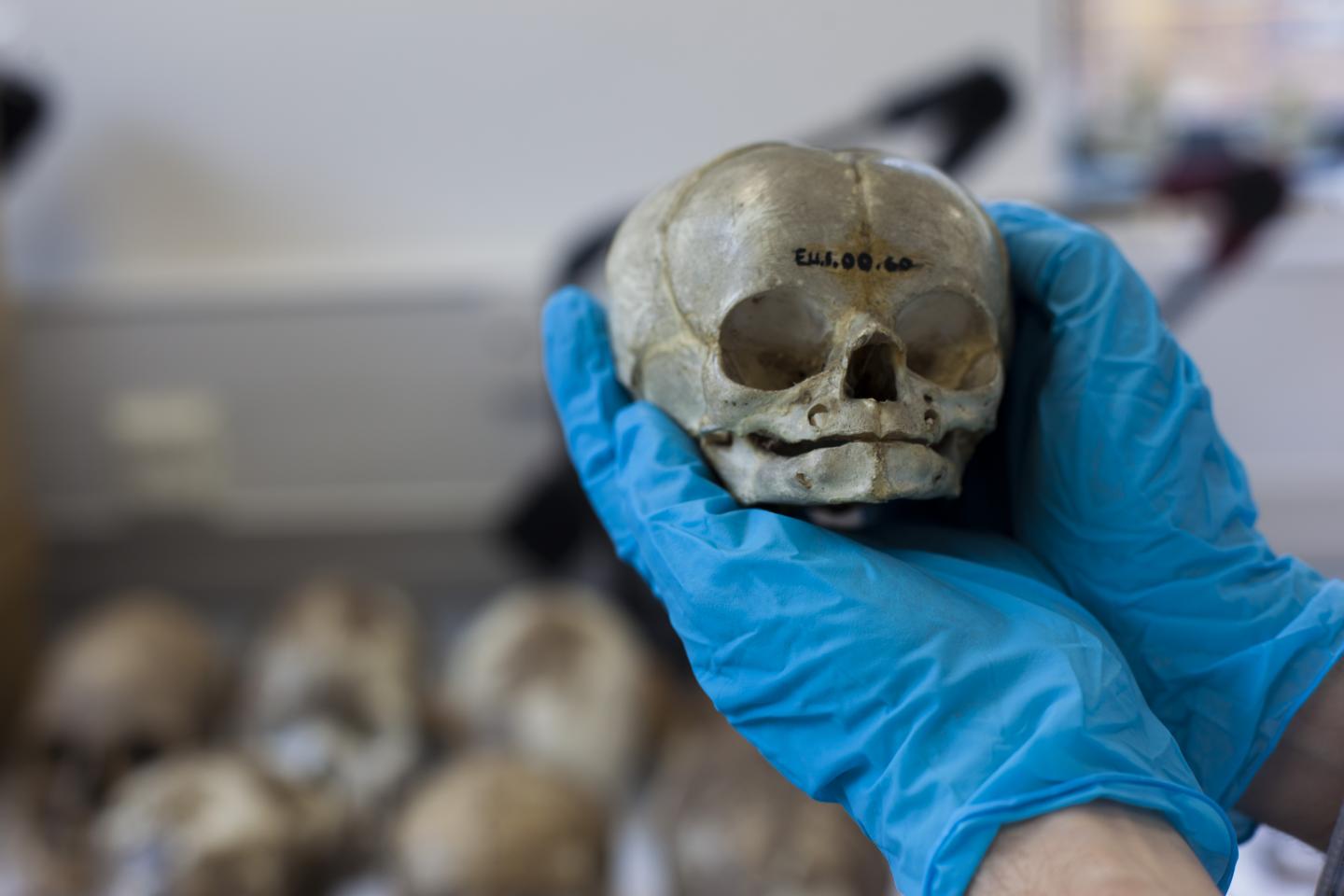 Dissected Fetal Skull (2 of 2)