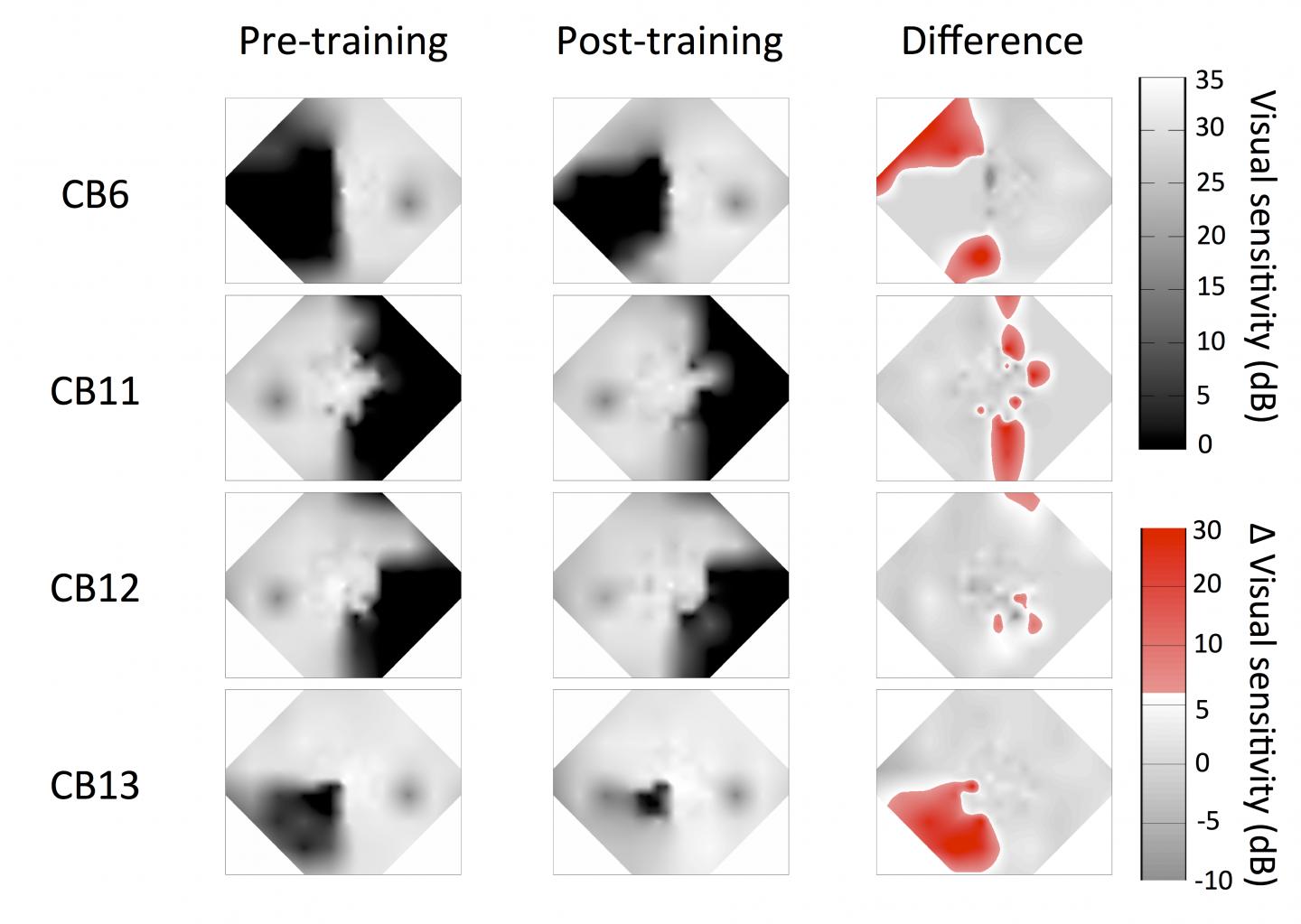 Visual Maps of Trained Patients
