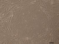 Colony of Human Induced Pluripotent Stem Cells