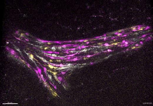 Breast myoepithelial cell