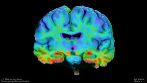 Tau in the brain