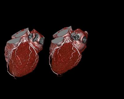 Multi-Slice Computed Tomography (CT) Imaging Technology at Penn