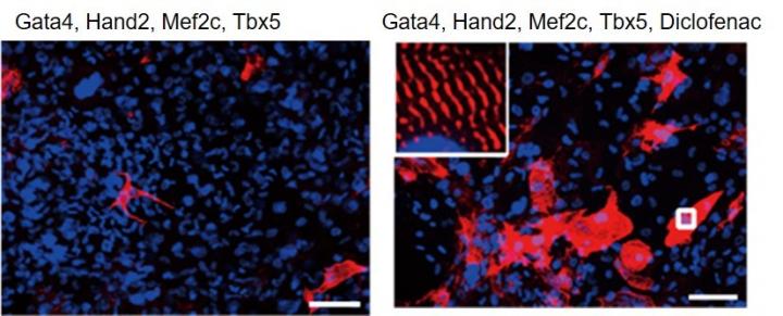 Anti-Inflammatory Drug is the Key to Boosting Cardiac Reprogramming
