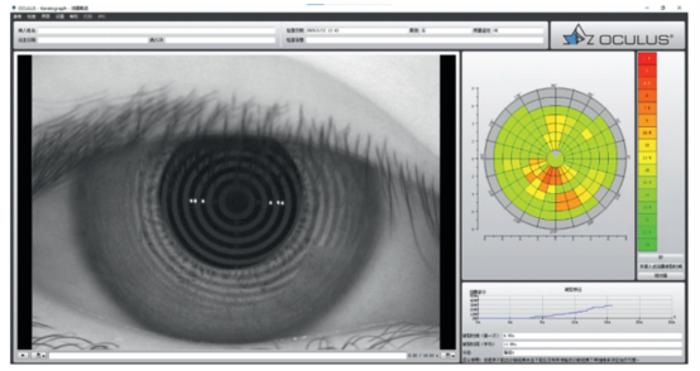 NIBUT software analysis
