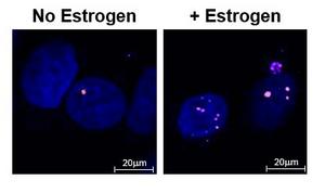 Estrogen triggers DNA damage in breast cancer cells