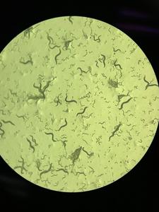 C. elegans roundworms on an agar plate under magnification.