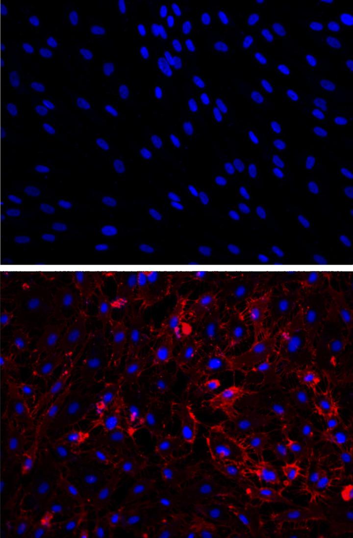 Scar Cells Transformed into Blood Vessel Sells