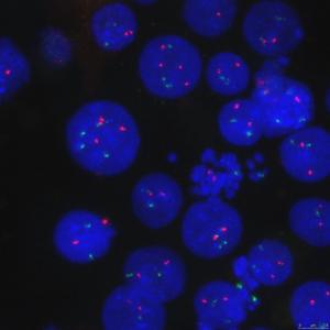 Engineered mantle cell lymphoma cells