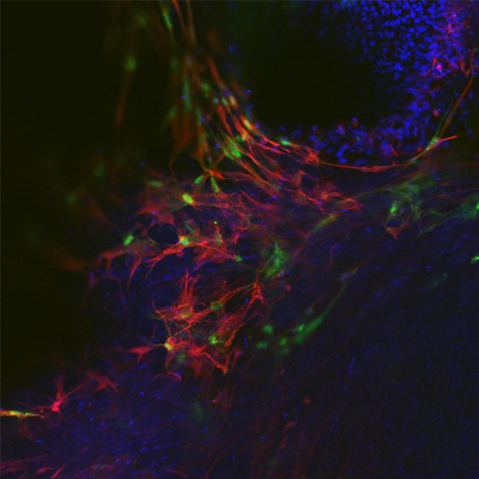 stem cell treatment forming crucial support system