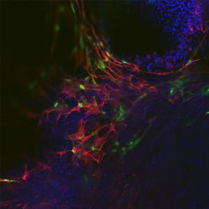 stem cell treatment forming crucial support system