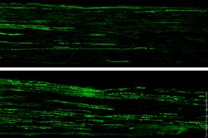 Regeneration of nerve fibres